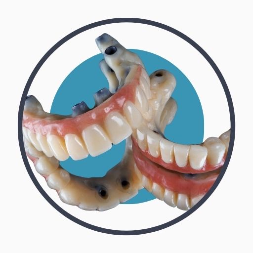 Preparation for Dental Implant Surgery