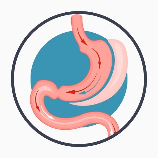 Overview of Gastric Sleeve Surgery

