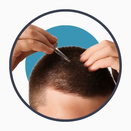 Recovery After the Procedure