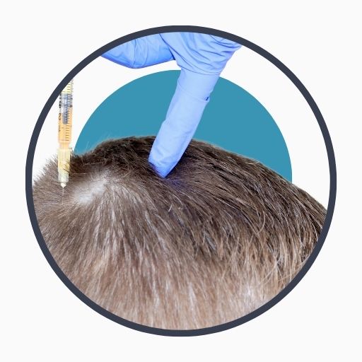 Risks of Hair Transplant