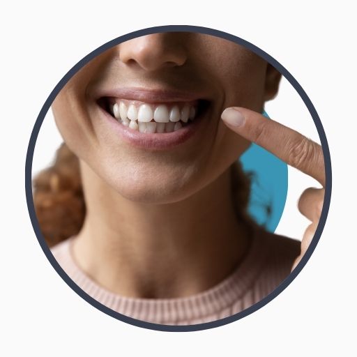What is the Best Hollywood Smile? Who Is It Suitable For? Veneer Shades