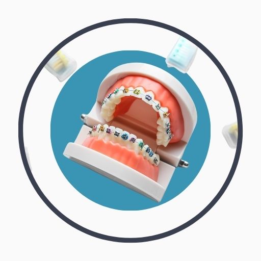 Benefits of Orthodontic Treatment