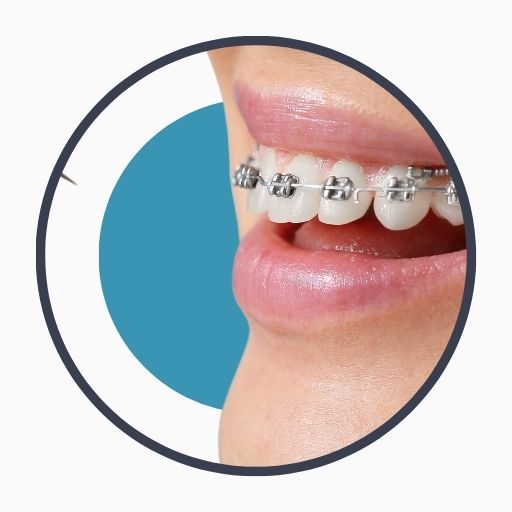 Overview of Orthodontics