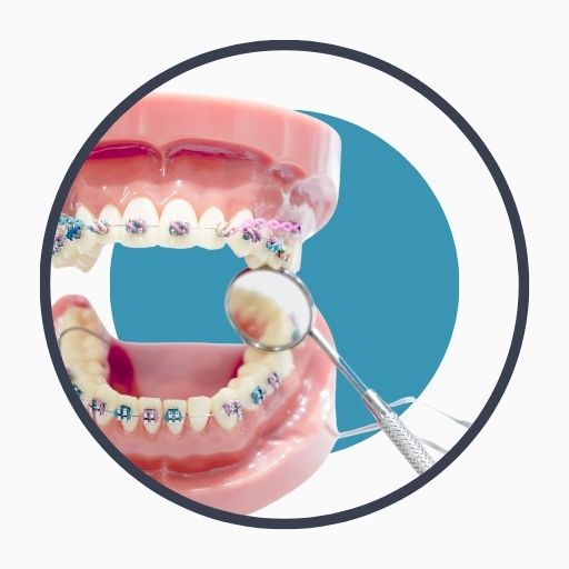 Steps to Get Orthodontic Treatment