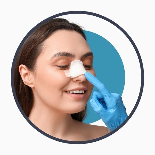 Benefits of Rhinoplasty