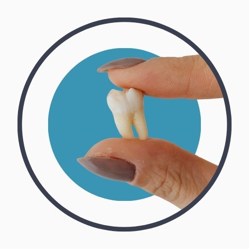 What is Tooth Extraction?