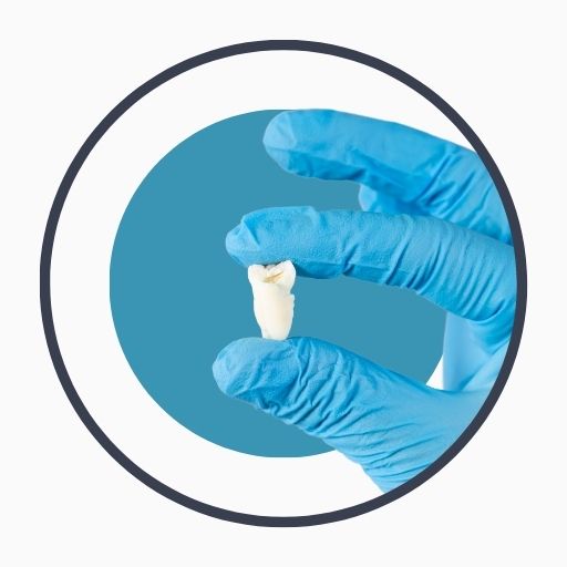Tooth Extraction Method